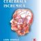 Viorel Pais – Ateroscleroza cerebrală ischemică